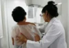 Breast Ultrasound